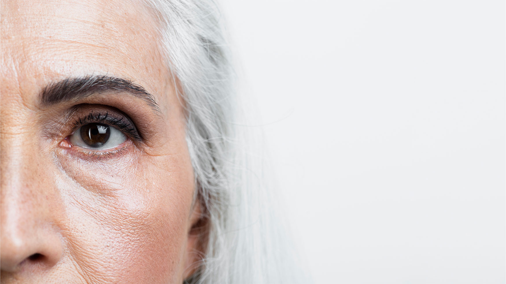 Ojeras marcadas: causas y tratamientos para recuperar una mirada descansada y radiante
